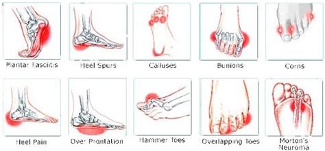 Do you suffer from pain in your foot arch? Put Your Feet in Our Hands