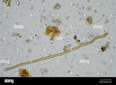 plant cellulose in a soil sample under the microscope on a farm Stock Photo - Alamy