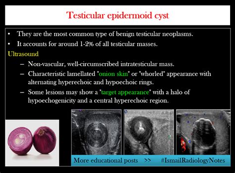 Pin on Scrotal Ultrasound -Dr. Ismail Sayed Ismail