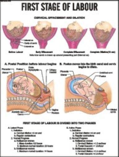 Stages of Labor and Delivery | First Stage of labour | Labor nurse, Stages of labor, First stage ...