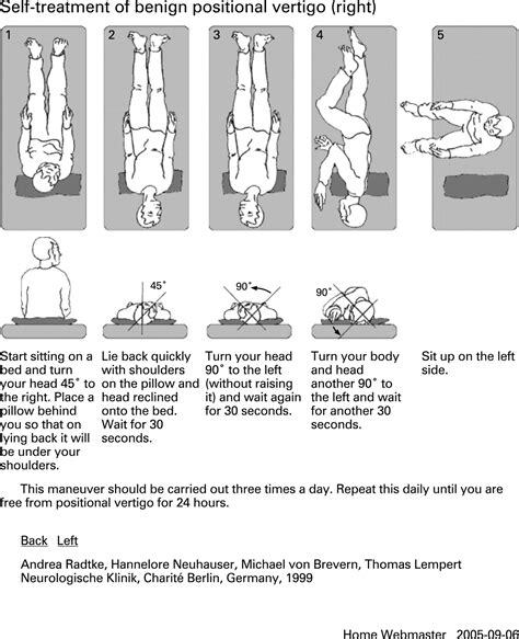 Home Epley Maneuver Diagram