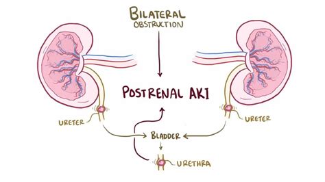 Azotemia: Types, Causes, Symptoms Treatment, 56% OFF