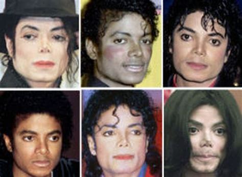 Michael Jackson Plastic Surgery: A Failed Cosmetic Procedure