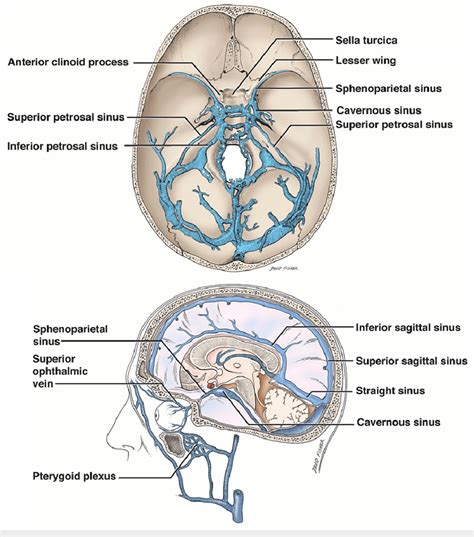 Schematic drawings of the dural venous sinuses of the skull base noting... | Download Scientific ...