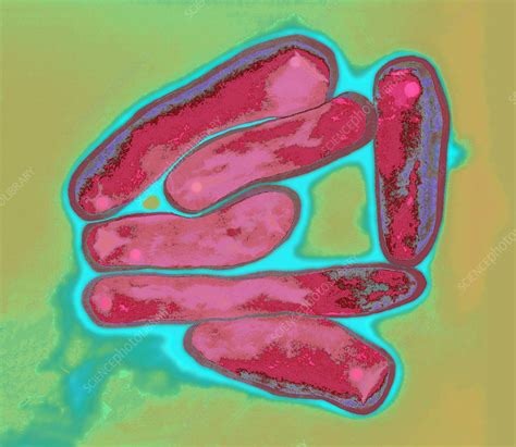 Mycobacterium bovis, TEM - Stock Image - B220/1351 - Science Photo Library