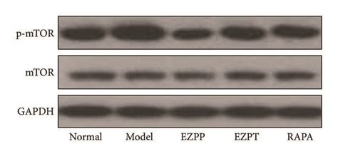 Western blot analysis of mTOR and p-mTOR. (a) Western blot of mTOR and... | Download Scientific ...