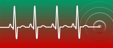 Delta Wave ECG – Why It Should Be The Main Standard For Cardiac Monitors