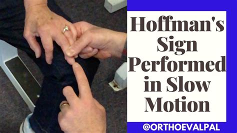 Hoffman's Reflex Test / Strange Reflexes And What They Say About Your Health / Establish ...