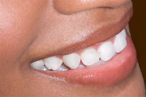 Ethnic Black African-American Woman Teeth Closeup Stock Photo - Image ...