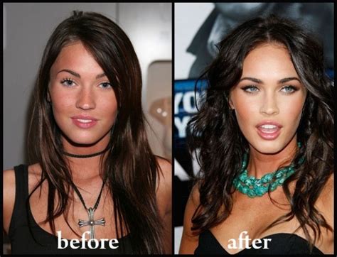 MEGAN FOX PLASTIC SURGERY BEFORE AFTER PICTURES