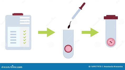 Stages of in Vitro Fertilization Protocol. Flat Stock Illustration - Illustration of chart ...