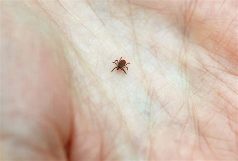 Don't Panic If You Get Bit By A Tick. Here Are 5 Tips To Minimize Lyme : Shots - Health News : NPR