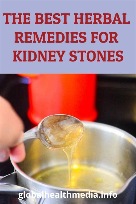 The Best Herbal Remedies for Kidney Stones | Kidney stones remedy, Herbalism, Herbal remedies