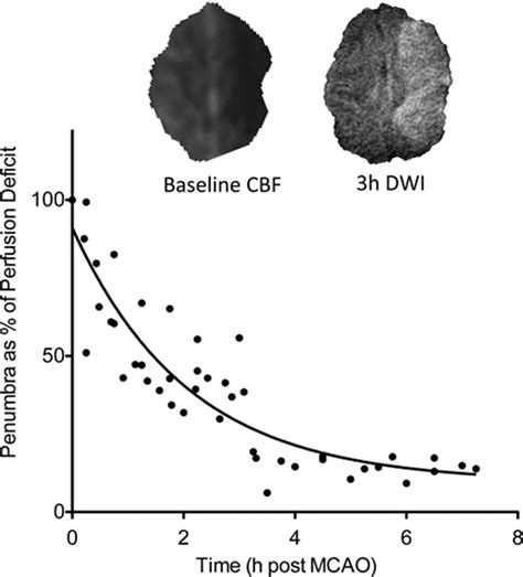 Novel Approaches to Neuroprotection Trials in Acute Ischemic Stroke ...