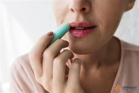 The Truth About Your Lip Balm Addiction | Epiphany Dermatology