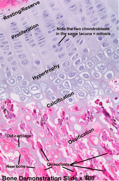 Pin on Histology - Cartilage and Bone