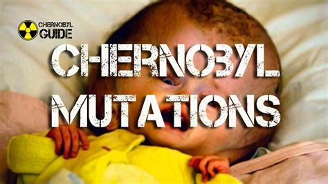 Chernobyl Kids Mutations : New Chernobyl Shock Russian Disaster Killed 200 British Babies ...