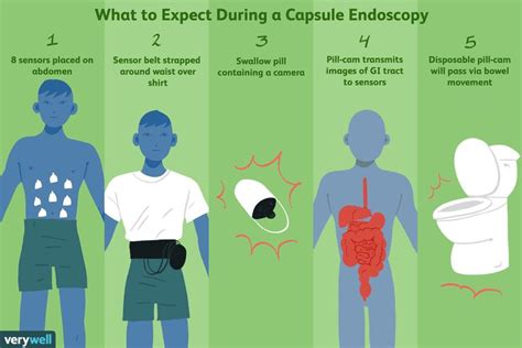 Capsule Endoscopy Uses, Side Effects, and Results | Capsule, Gastrointestinal disorders ...