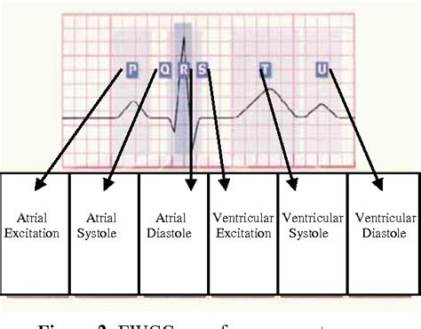 Figure 1 from Atrial Excitation Atrial Systole Atrial Diastole ...