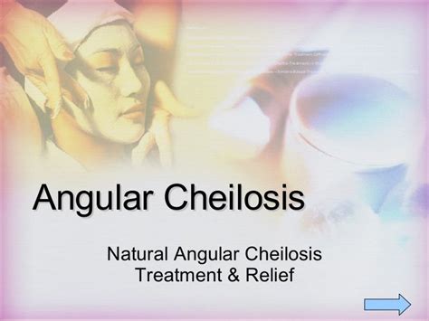 Cheilosis and Angular Cheilosis Treatment - Natural Treatment For Ang…