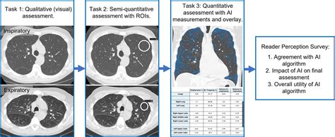 Reader Perceptions and Impact of AI on CT Assessment of Air Trapping ...