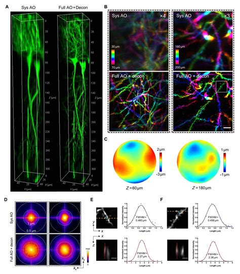 Deep Thoughts Imaging Brain Scan Brain Scan Deep Learning Data Patterns ...