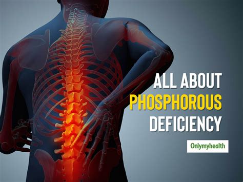 Phosphorus Deficiency: Know The Causes, Symptoms and Health Problems | OnlyMyHealth