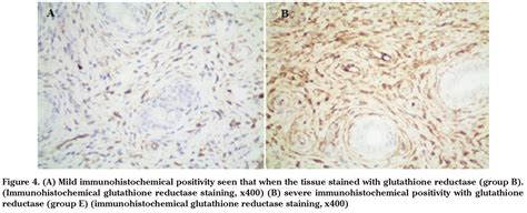 The immunohistochemical and histologic effects of contrast medium on uterus, fallopian tubes and ...