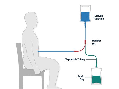 Peritoneal Dialysis Ati Template