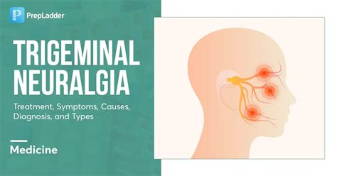 Trigeminal Neuralgia Treatment, Symptoms, Causes, and Types