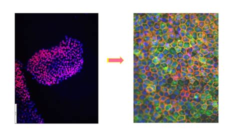 Human embryonic stem cells – from derivation to clinical regenerative ...