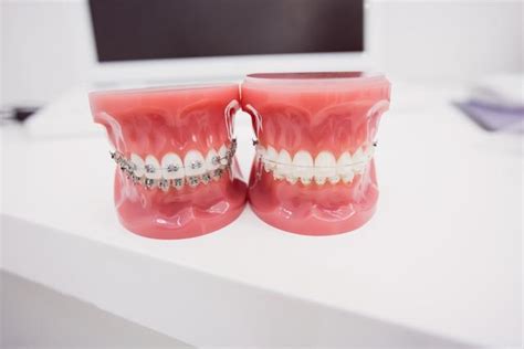 20+ Free close up teeth images - Pikwizard