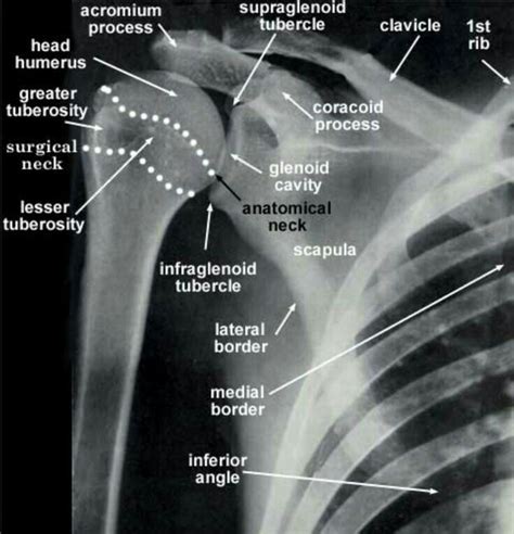 Pin by Luvenia Hamilton on x-ray | Radiology schools, Radiology student, Medical knowledge