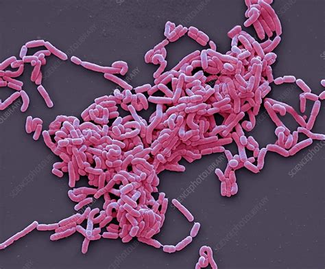 Lactobacillus casei bacteria, SEM - Stock Image - F004/0832 - Science ...