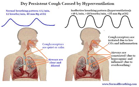 Cause of Cough, Home Remedies for Acute Morning Coughing