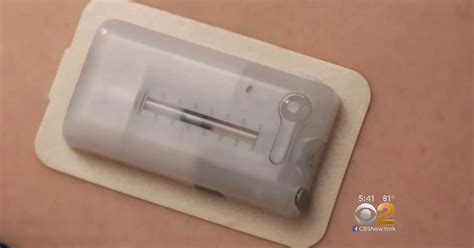 So Long, Syringes: New Insulin Patch Makes It Easier To Manage Diabetes ...