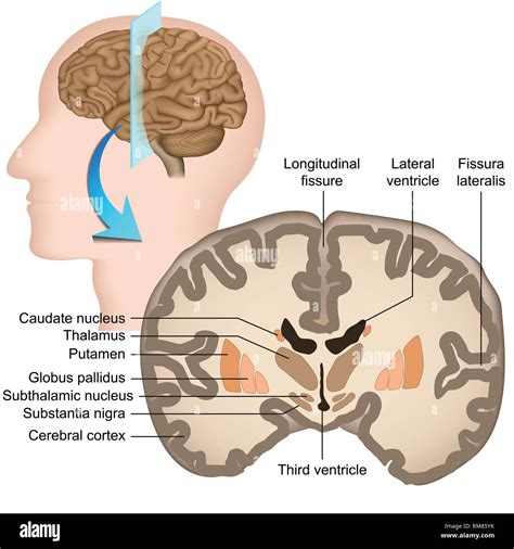 Cerebro Ringana