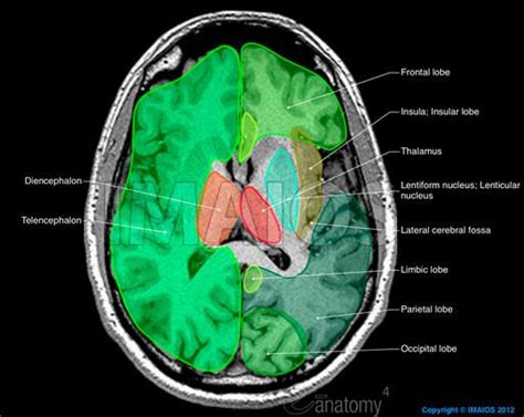 Brain: Atlas of human anatomy with MRI | Mri brain, Mri, Anatomy