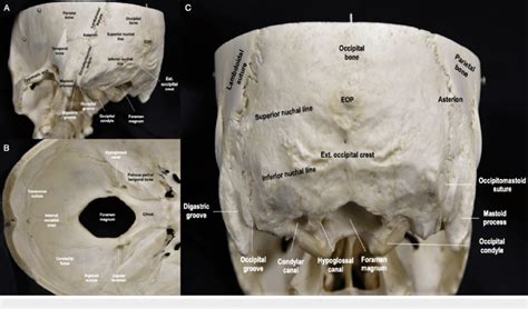 Overview of the occipital bone anatomy. (A) Posterolateral perspective ...