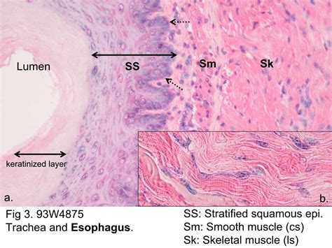 Skeletal Muscle Cell Under Microscope - Chapter 7, Page 4 ...