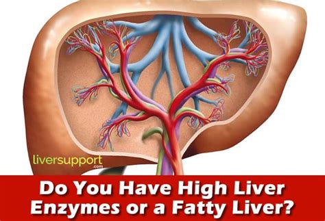 Do You Have High Liver Enzymes or a Fatty Liver? - LiverSupport.com