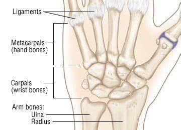 Wrist Sprain Guide: Causes, Symptoms and Treatment Options