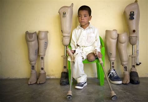 Land mine victims in Afghanistan - Photos - UPI.com