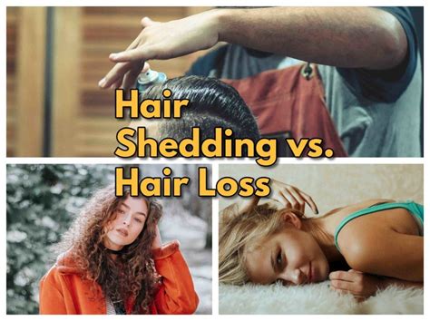 Hair Shedding vs. Hair Loss: What’s the Difference? - Thyroid And ...