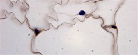 Evidence of apoptosis by TUNEL staining method. | Download Scientific Diagram