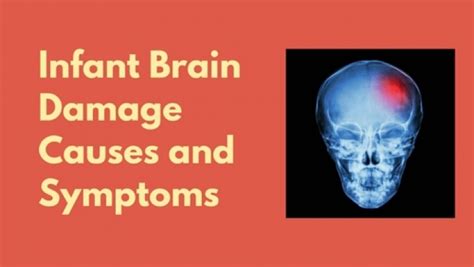 Infant Brain Damage Causes and Symptoms