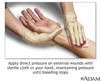 Bleeding Information | Mount Sinai - New York