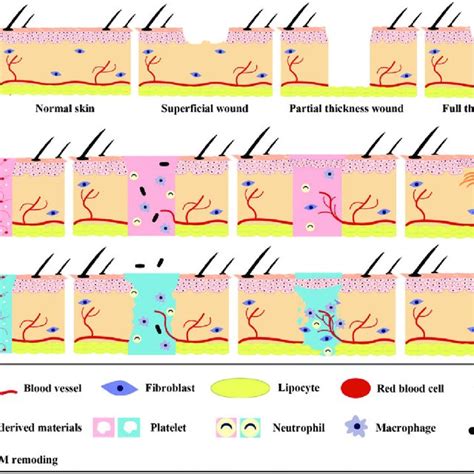 Diagrammatic sketch of wounds and wound healing. (a) classification of ...