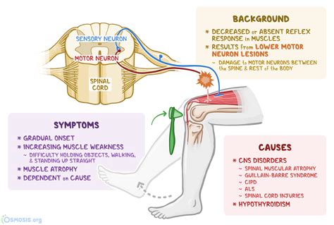 Hyporeflexia: What Is It, Causes, Important Facts, and More | Osmosis