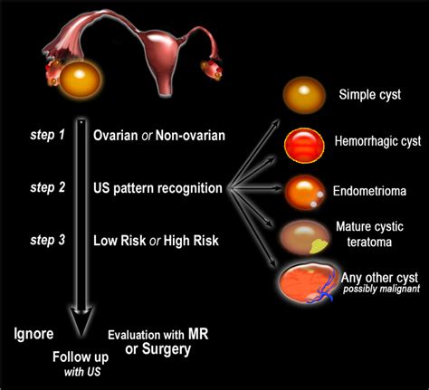 The Radiology Assistant : Ovarian Cysts - Diagnostic Work and Roadmap